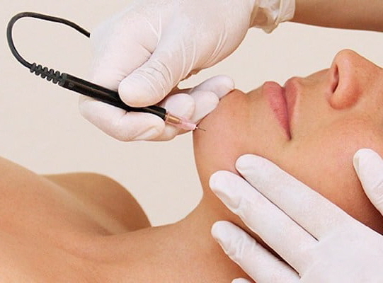 Electrolysis